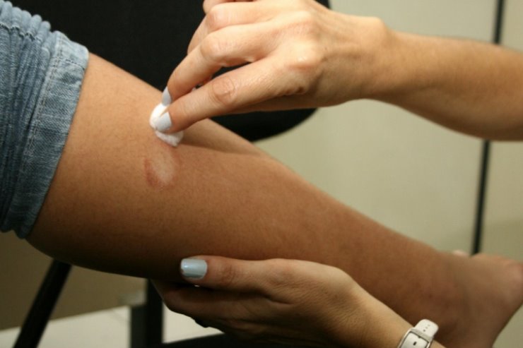 Imagem:  Nos últimos dez anos, foram diagnosticados cerca de 300 mil novos casos no Brasil